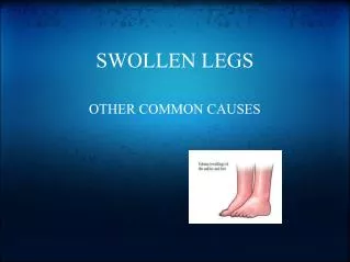 SWOLLEN LEGS