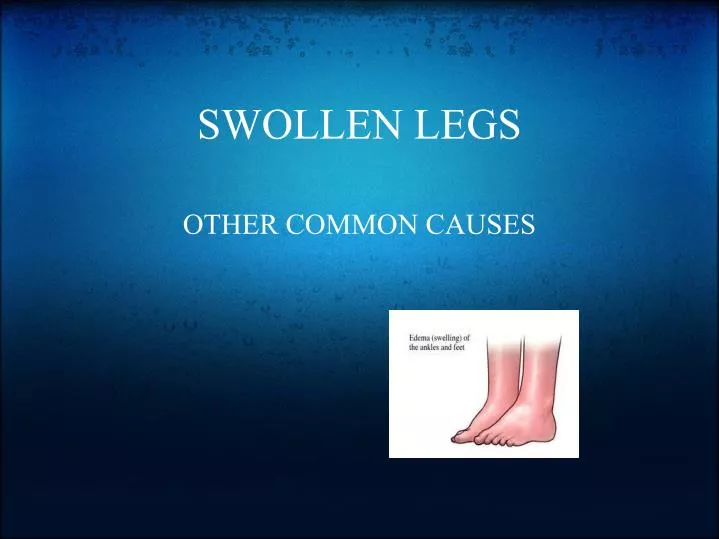 swollen legs
