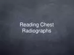 Reading Chest Radiographs - slide 1