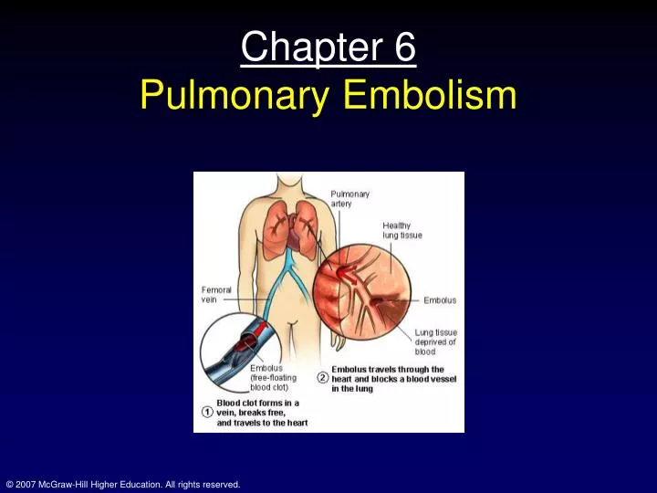 chapter 6 pulmonary embolism