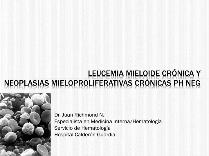 leucemia mieloide cr nica y neoplasias mieloproliferativas cr nicas ph neg
