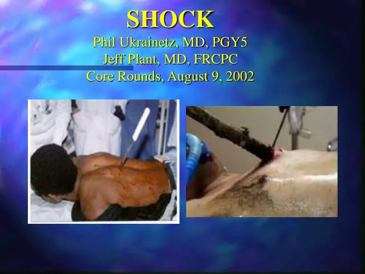 shock phil ukrainetz md pgy5 jeff plant md frcpc core rounds august 9 2002