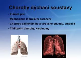 choroby d chac soustavy