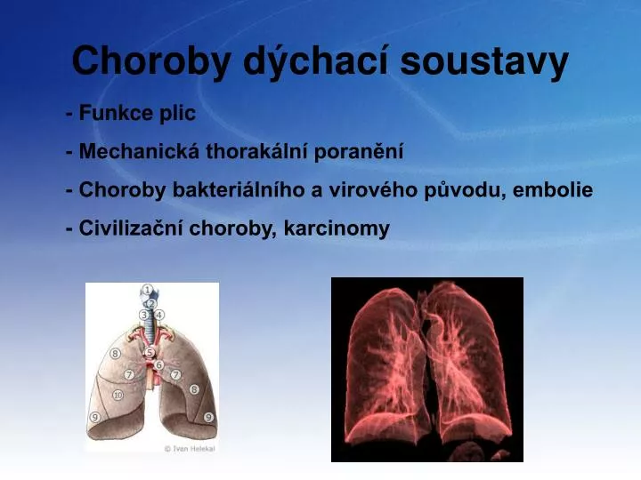choroby d chac soustavy
