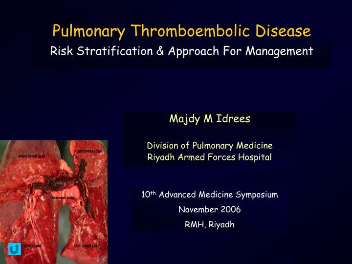 pulmonary thromboembolic disease risk stratification approach for management
