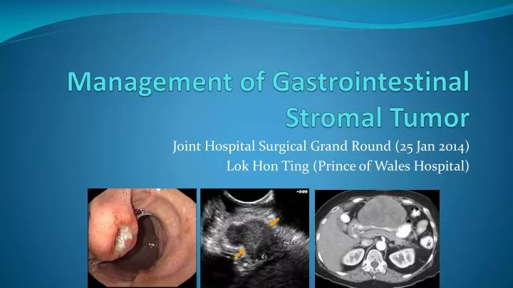 management of gastrointestinal stromal tumor
