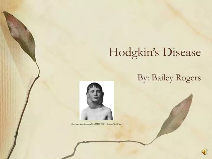 hodgkin s disease