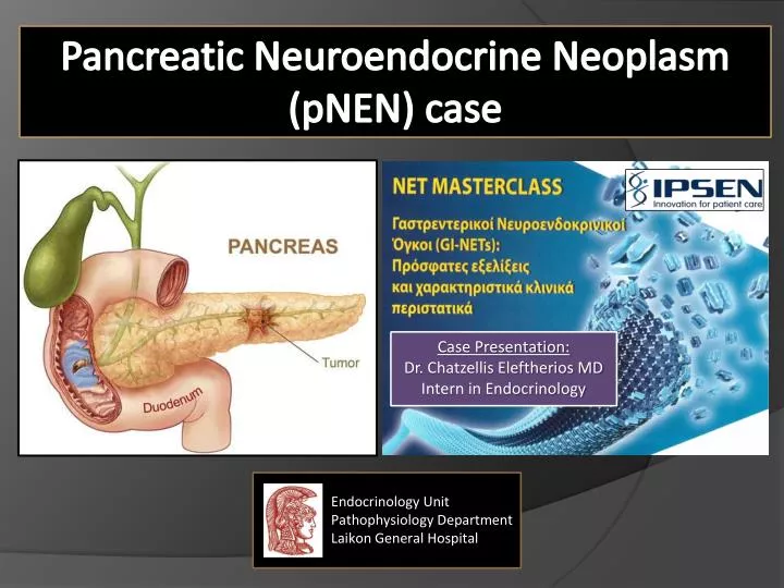 pancreatic neuroendocrine neoplasm pnen case