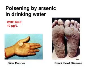 Poisening by arsenic in drinking water