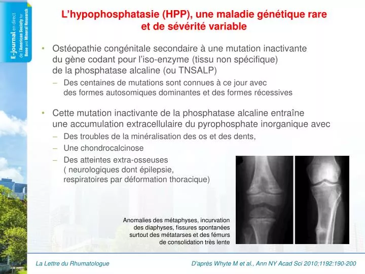 l hypophosphatasie hpp une maladie g n tique rare et de s v rit variable