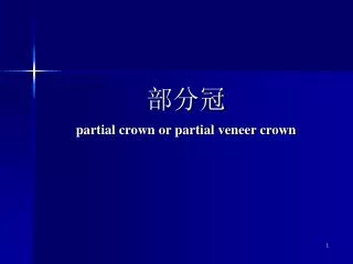 partial crown or partial veneer crown