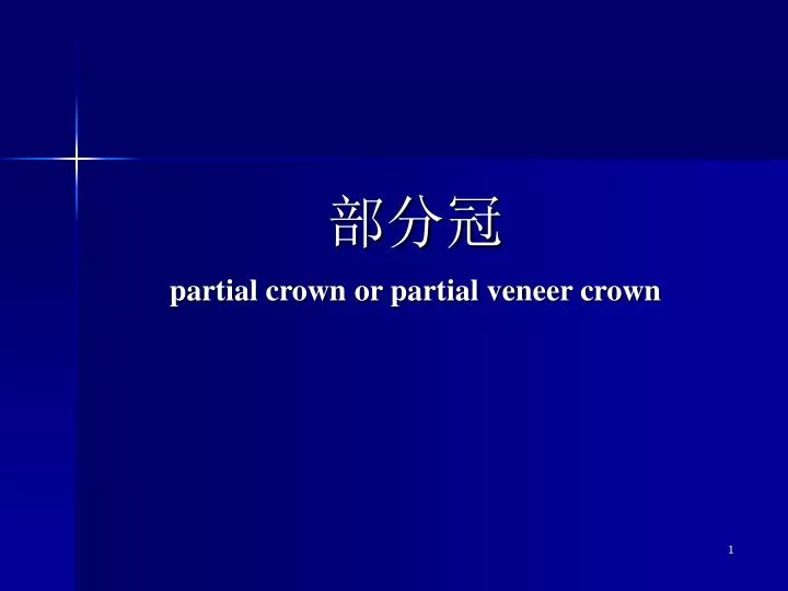 partial crown or partial veneer crown