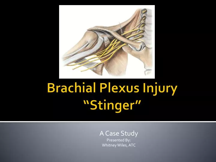 brachial plexus injury stinger