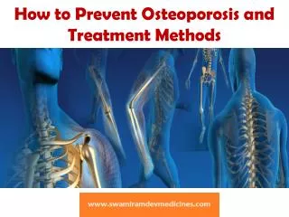 How to Prevent Osteoporosis and Treatment Methods