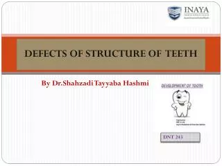 DEFECTS OF STRUCTURE OF TEETH