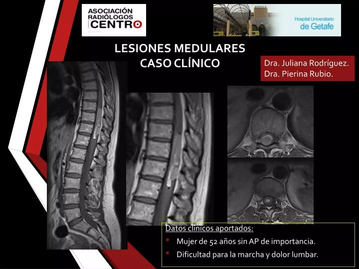 lesiones medulares caso cl nico