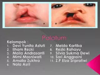 palatum