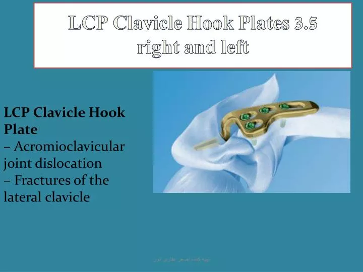 lcp clavicle hook plates 3 5 right and left