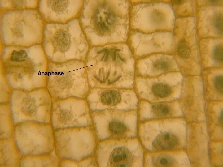 plant mitosis anaphase