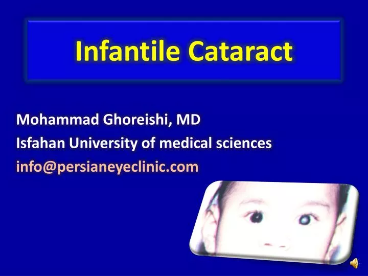 infantile cataract