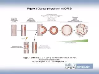 Figure 3 Disease progression in ADPKD
