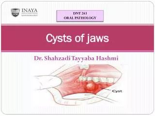 Cysts of jaws