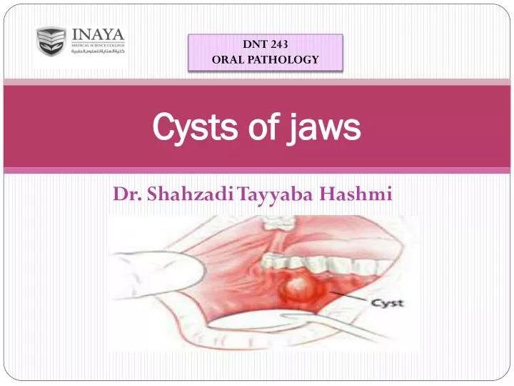 cysts of jaws