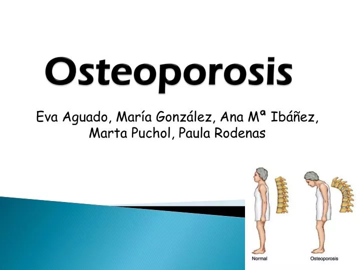 osteoporosis