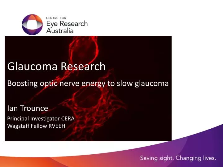 glaucoma research