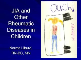 JIA and Other Rheumatic Diseases in Children