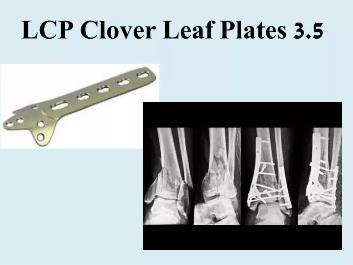 lcp clover leaf plates 3 5