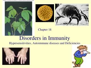 Disorders in Immunity Hypersensitivities, Autoimmune diseases and Deficiencies