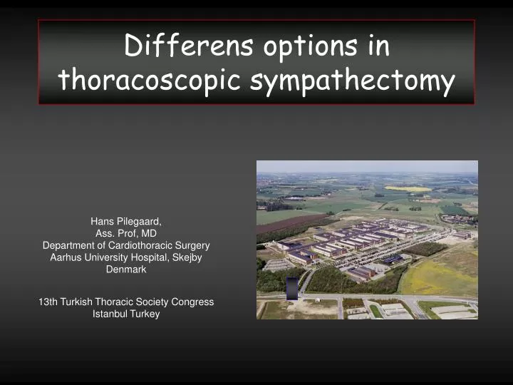 differens options in thoracoscopic sympathectomy