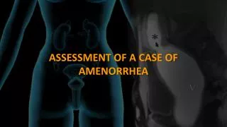 ASSESSMENT OF A CASE OF AMENORRHEA