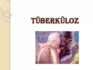 t berk loz