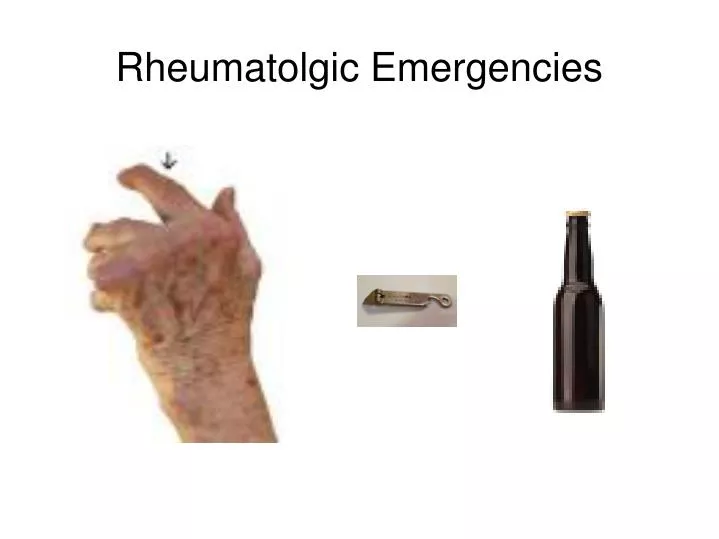 rheumatolgic emergencies