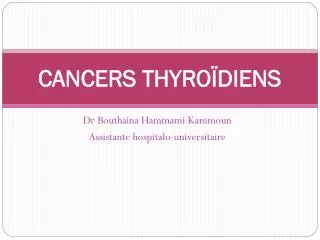 cancers thyro diens