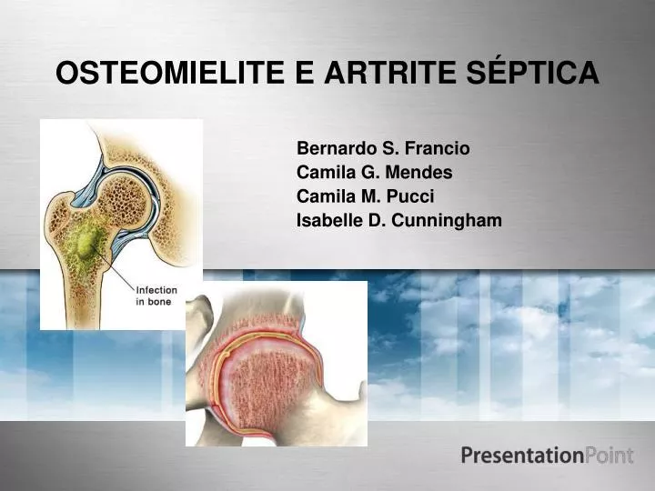 osteomielite e artrite s ptica
