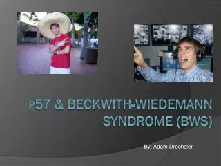 p 57 &amp; Beckwith- Wiedemann syndrome (BWS)