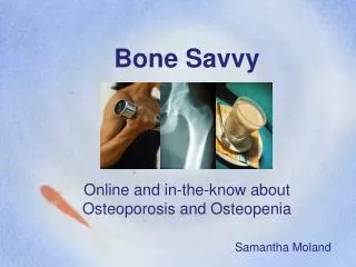 Bone Savvy