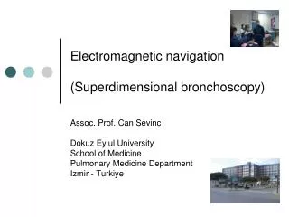 Electromagnetic navigation (Superdimensional bronchoscopy)
