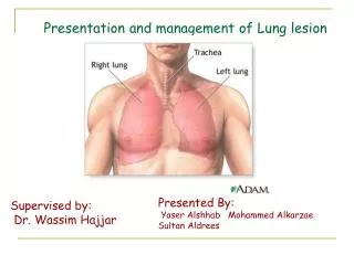 Presentation and management of Lung lesion