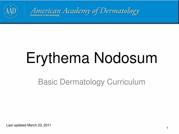 erythema nodosum