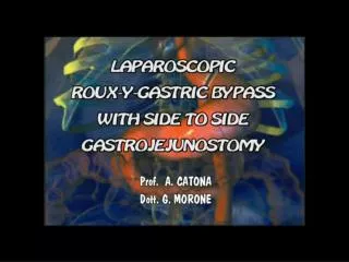 BY PASS GASTRICO LAPAROSCOPICO PERCHE’ L’ANASTOMOSI G-D LINEARE