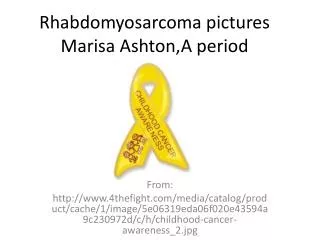 Rhabdomyosarcoma pictures Marisa Ashton,A period