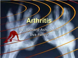 arthritis