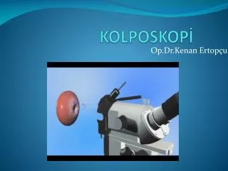 kolposkop
