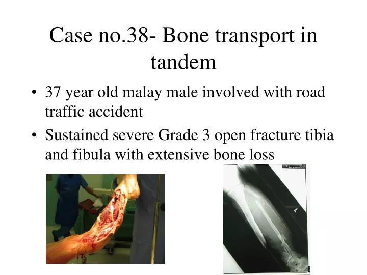 case no 38 bone transport in tandem