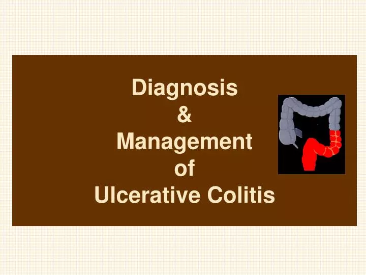 Clinical review of ulcerative colitis: epidemiology, diagnosis and  management
